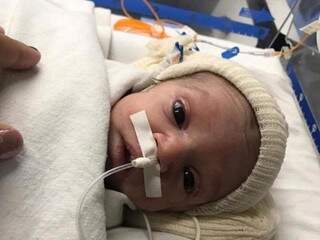 Um dia após nascer, Ulisses já passou pela primeira cirurgia (Foto: Arquivo pessoal)