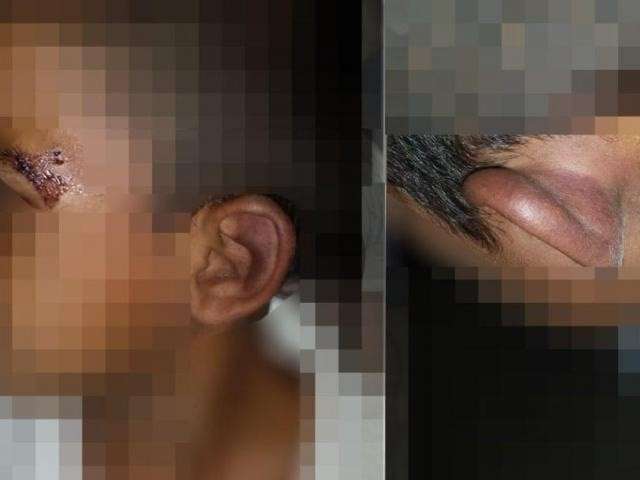 Crian&ccedil;a de 4 anos torturada pela m&atilde;e &eacute; enviada para abrigo 