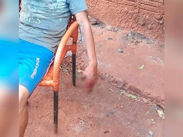 PM instaura inqu&eacute;rito para apurar se policiais usaram granada em conflito 
