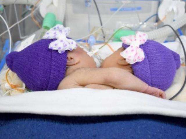 Exames &quot;milim&eacute;tricos&quot; v&atilde;o definir destino de Maria J&uacute;lia e Luna Vit&oacute;ria