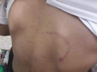 Marcas de fios e agressões pelo corpo e rosto da criança. (Foto: O Correio News)