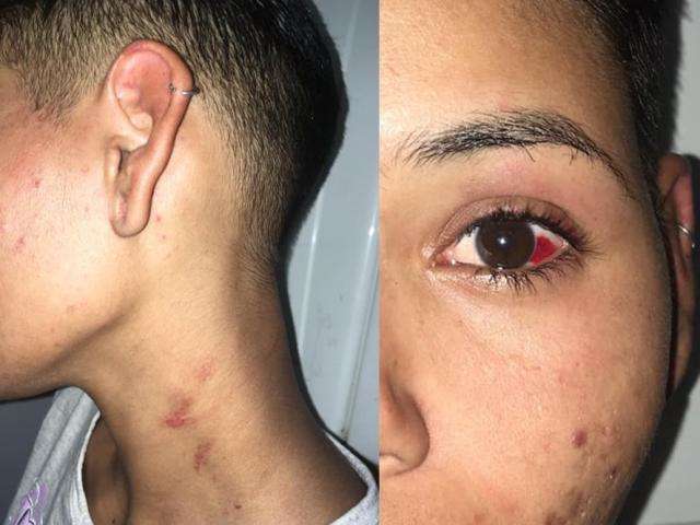 Mulher denuncia ex-namorado tatuador por agress&otilde;es ap&oacute;s festa no Carnaval
