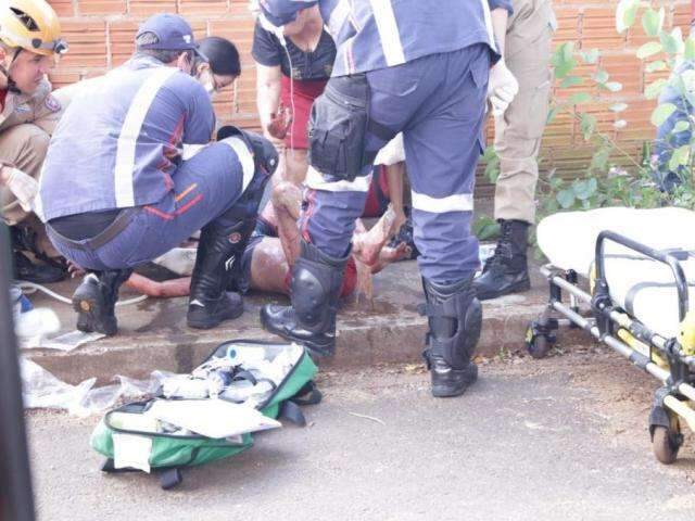 Depois de 1 ano internada, crian&ccedil;a que teve o corpo queimado morre no hospital