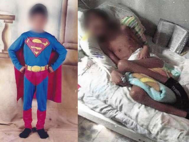 Por erro m&eacute;dico, hospital pagar&aacute; R$ 200 mil a menino que vegeta h&aacute; 8 anos