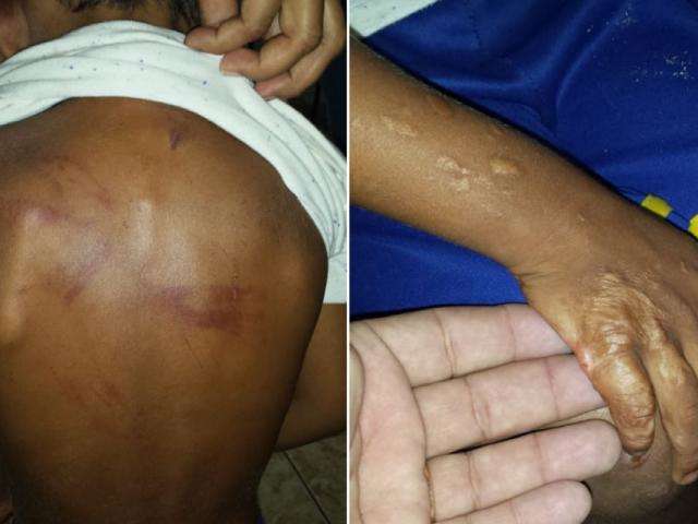 Ferida e com queimaduras, crian&ccedil;a &eacute; resgatada e m&atilde;e presa por tortura