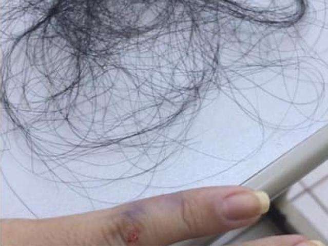 Enfermeira &eacute; agredida por m&atilde;e de paciente suspeito de usar droga em hospital 