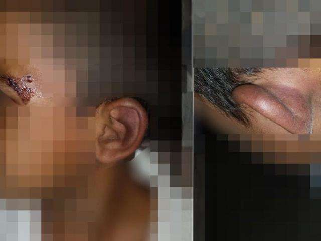 Crian&ccedil;a de 4 anos torturada pela m&atilde;e ficou 12 horas sem socorro 