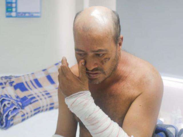 Atacado por pit bull, Carlos chora e pede ajuda para voltar a SP