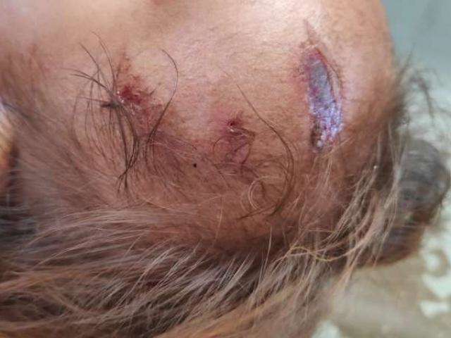 Em briga com esposa, homem atinge beb&ecirc; com golpe de foice