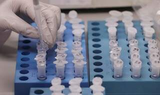 Teste sendo feito em laboratório. (Foto: Reuters/Yves Herman/ReproduçãoAgênciaBrasil)