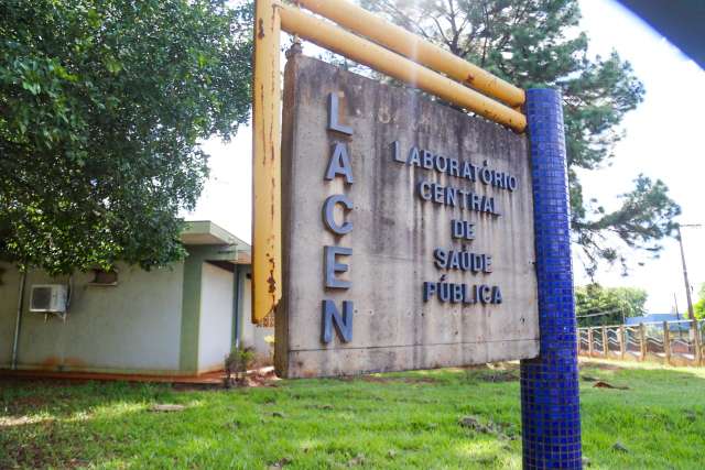 Lacen j&aacute; realizou 480 testes desde o in&iacute;cio da pandemia