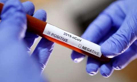 Brasil registra 553 mortes e mais de 12 mil casos confirmados por coronavírus