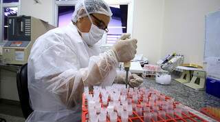 Segundo secretário de Saúde, 5 mil testes de biologia molecular também foram adquiridos (Foto: Edemir Rodrigues/Governo de MS)