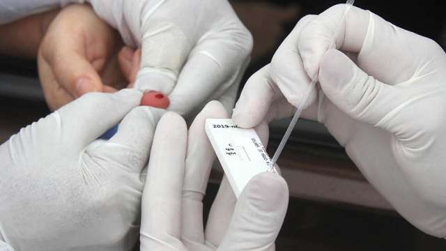 Em laborat&oacute;rios particulares, exames de covid v&atilde;o de R$ 210 a R$ 450