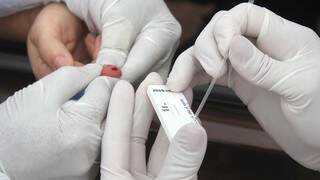Teste rápido fica pronto em até três horas e usa apenas uma gota de sangue para identificar os anticorpos do vírus. (Foto: Futura Press)
