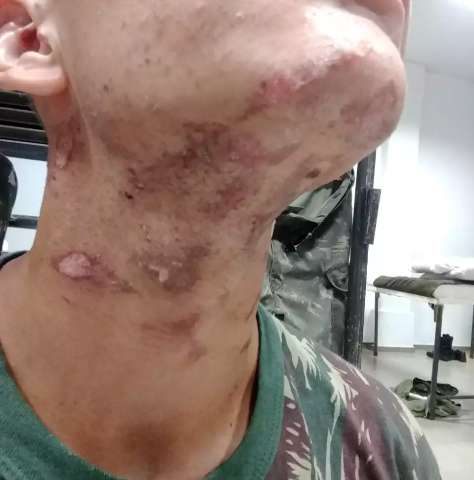 Depoimento de recruta mostra tentativa de abafar tortura dentro de quartel