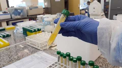 Governo vai repassar R$ 852 mil para novo laboratório de testes da UFMS