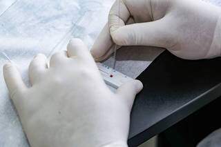 Profissional usa amostra de sangue para teste rápido da covid-19. (Foto: Kisie Ainoã)