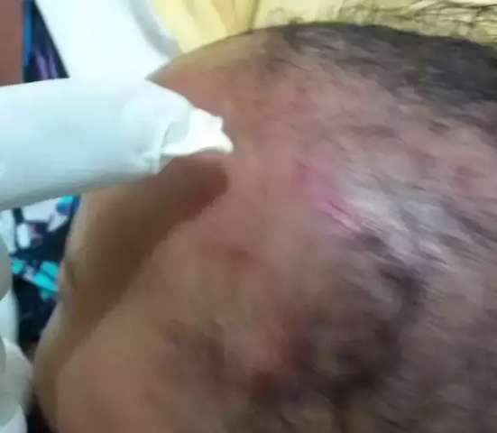 Ap&oacute;s den&uacute;ncia de maus tratos, beb&ecirc; de 5 meses &eacute; encontrado com cr&acirc;nio fraturado