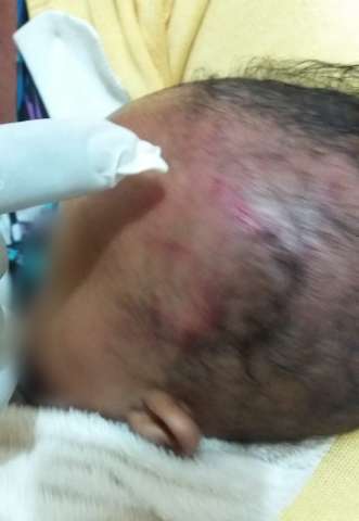 Beb&ecirc; que teve cr&acirc;nio fraturado recebe alta e &eacute; levado para abrigo