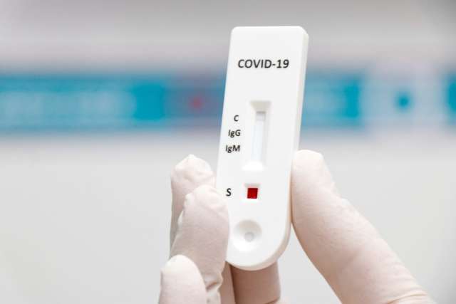 Lei sancionada d&aacute; prioridade a profissionais essenciais para testes de covid-19