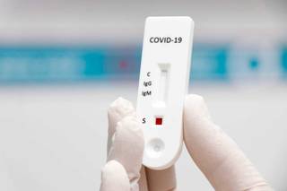 Teste rápido de covid-19, que terá de ser priorizado a profissionais de saúde segundo lei publicada. (Foto: Arquivo/Campo Grande News)