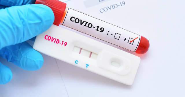No estado, teste &quot;padr&atilde;o&quot; para detectar covid tem varia&ccedil;&atilde;o de 60% no pre&ccedil;o