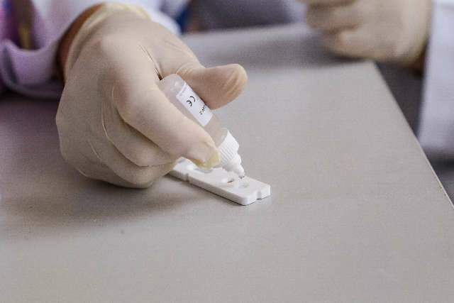 Covid-19 causou 1.110 mortes e foi diagnosticada em mais 33 mil pessoas em 24h