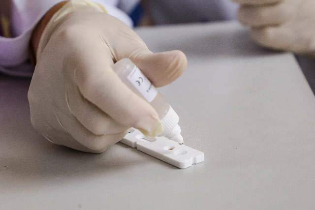 Exames para covid-19 duplicam e MS &eacute; o que mais testa no Pa&iacute;s, diz secret&aacute;rio