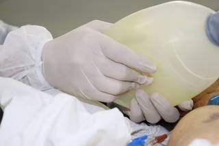 Paciente respirando or ambú, equipamento que exige a manipulação de um profissional de saúde o tempo toto (Foto: Santa Casa/Divulgação)