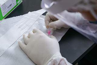 Técnico manipula teste rápido para detectar o coronavírus. (Foto: Kisie Ainoã)
