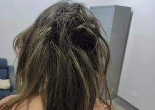 Em 12h de tortura, adolescente tem nariz quebrado e cabelo cortado com faca