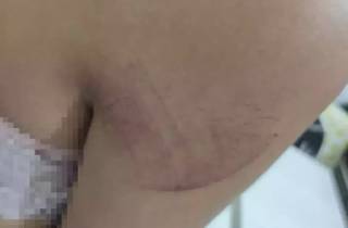 Em 12h de tortura, adolescente tem nariz quebrado e cabelo cortado com faca
