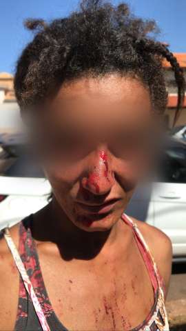 Cliente agride moradora de rua na sa&iacute;da de mercado