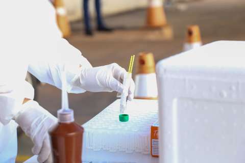 Nova m&aacute;quina vai permitir mais 1,1 mil exames de covid-19 por dia no Lacen