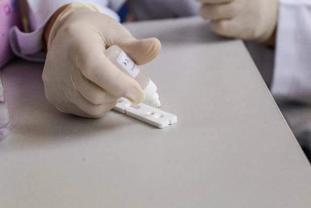 Prefeitura pode comprar at&eacute; R$ 2,4 milh&otilde;es em testes para covid-19