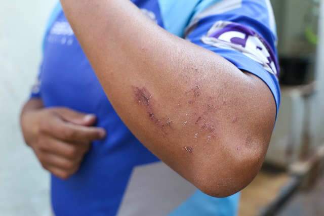 Dias ap&oacute;s se mudar para o Centro, homem apanha de ladr&otilde;es