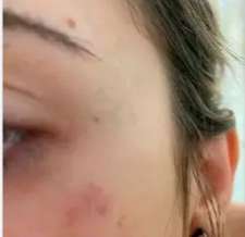 MP pede que m&eacute;dico acusado de agredir estudante pague fian&ccedil;a de R$ 60 mil