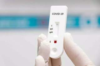 Teste rápido para detecção da covid-19 (Foto: Arquivo/Campo Grande News) 