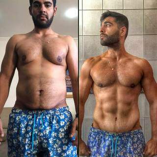 Antes e depois da abdominoplastia, a cirurgia de retirada do excesso de pele. (Foto: Arquivo Pessoal)
