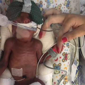 Mae Narra Os 126 Dias Na Uti De Bebe Que Nasceu De Apenas 23 Semanas Comportamento Campo Grande News