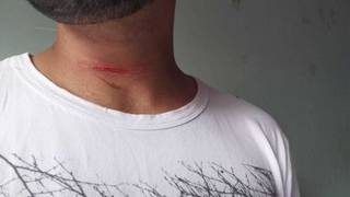 Motoqueiro teve pescoço ferido por linha chilena (Foto: Direto das Ruas)