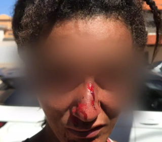 Defensoria abre procedimento para acompanhar caso de moradora de rua agredida
