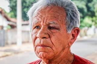 Antonio teve o olho picado pelas abelhas. (Foto: Henrique Kawaminami)