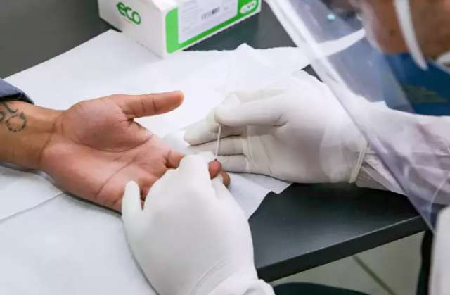Com 479 casos de covid em 24h, MS atinge 79,5 mil infectados