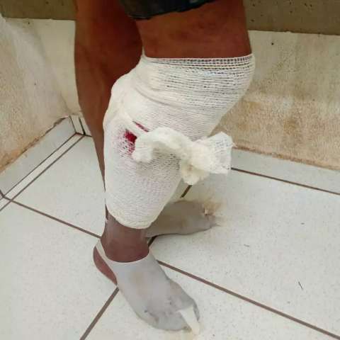 Assaltante com arma falsa &eacute; baleado e preso no Universit&aacute;rio
