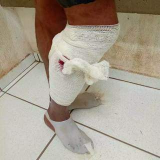 Assaltante foi baleado na perna (Foto: PMA/Divulgação)
