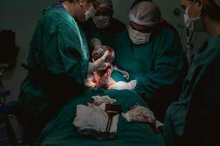 Imagem de cesariana sendo feita, depois de mãe entrar em trabalho de parto. (Foto: Paula Cayres)