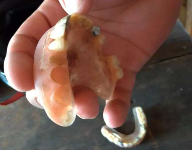 Idoso morre de covid e dentes de ouro de R$ 12 mil s&atilde;o furtados de pr&oacute;tese 