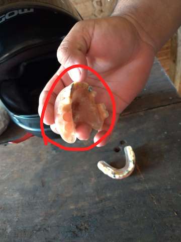 HR n&atilde;o sabe explicar sumi&ccedil;o de dente de ouro de paciente morto